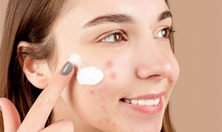 Rekomendasi Skincare Wajib untuk Kulit Berminyak dan Berjerawat
