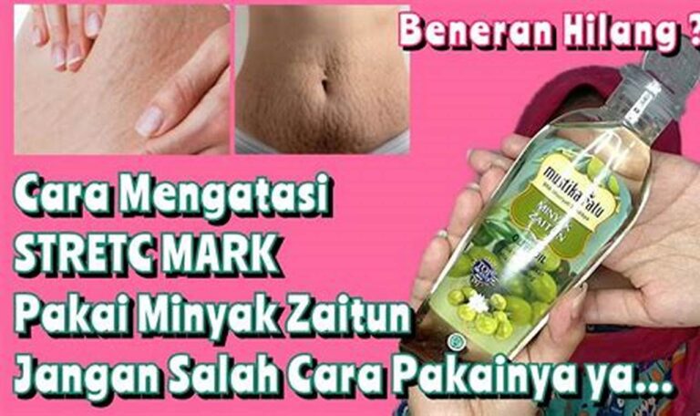 Mengapa Minyak Zaitun Ampuh Hilangkan Stretch Mark Secara Alami