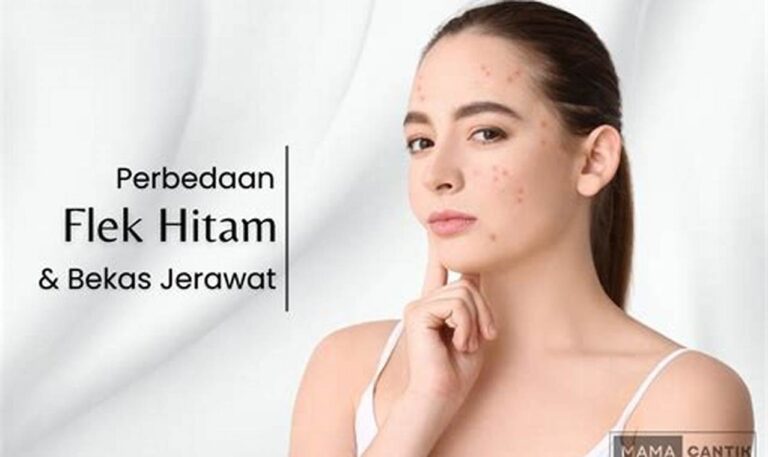 Rahasia Minyak Zaitun: Pudarkan Bekas Jerawat dan Flek Hitam!