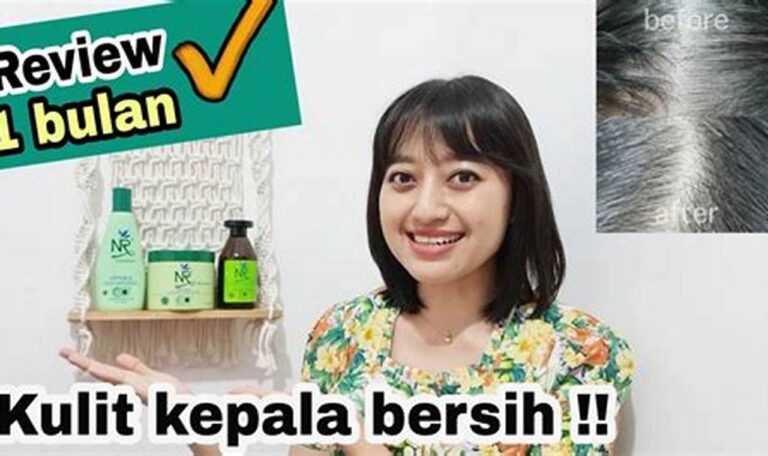 Solusi Ampuh Atasi Ketombe, Rambut Sehat Berkilau